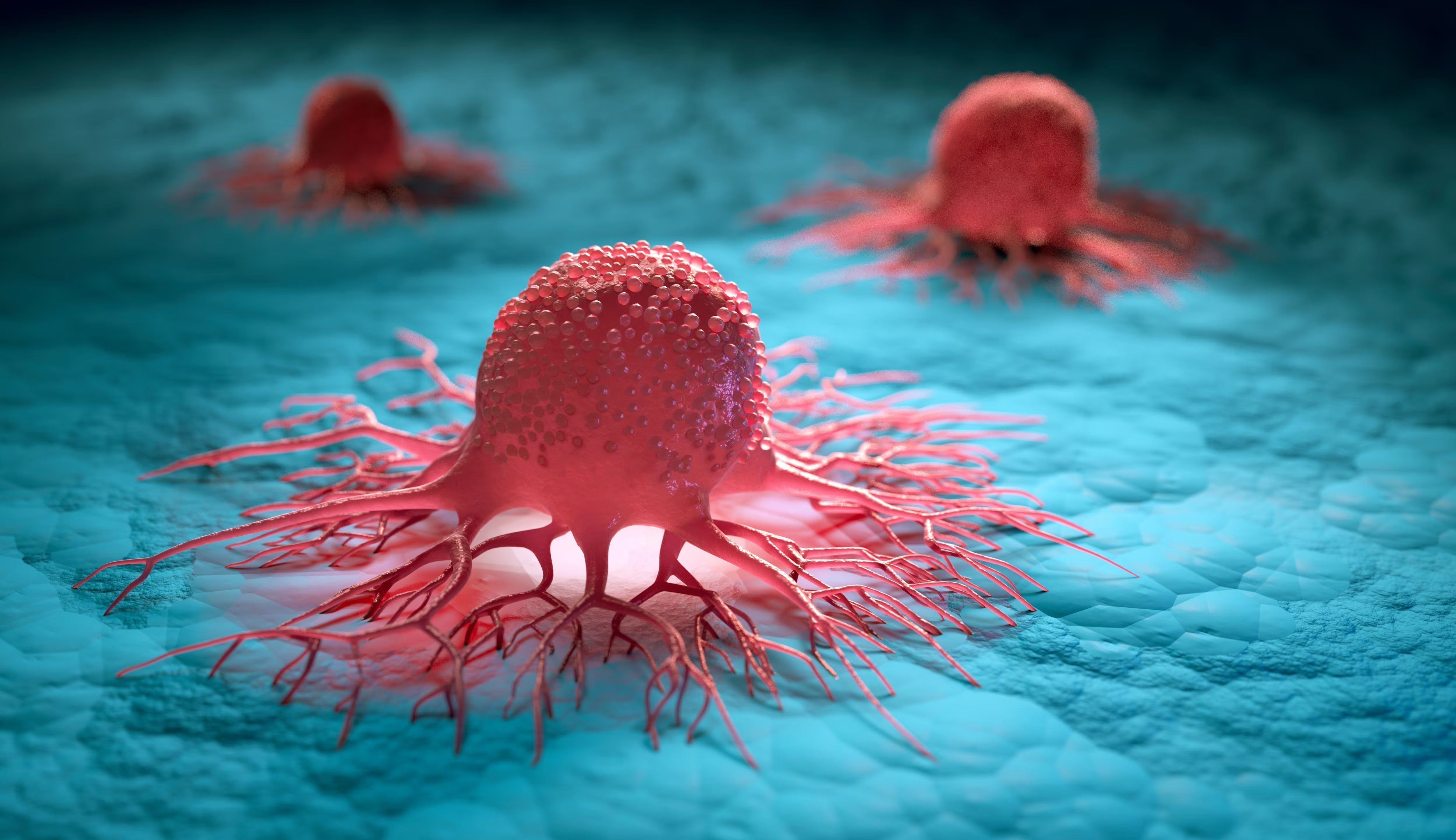 CID-10 • Capítulo II: Neoplasias (C00–D48)