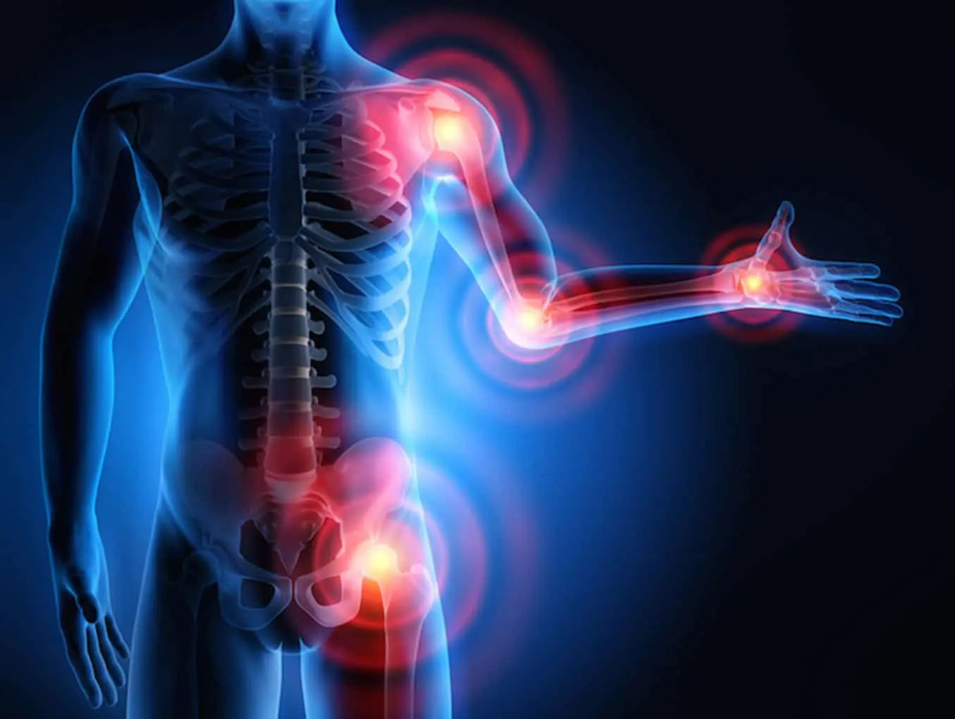 CID-10 • Capítulo XIII: Doenças do sistema osteomuscular e do tecido conjuntivo (M00–M99)